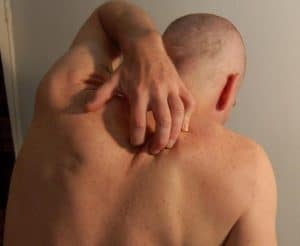 Démangeaisons de la peau sans boutons, possible consultation dermatologique à distance.